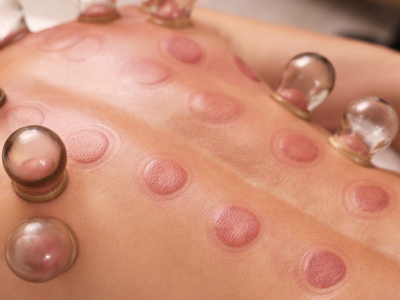 أفضل وقت لعمل الحجامة في شهر ديسمبر 2025