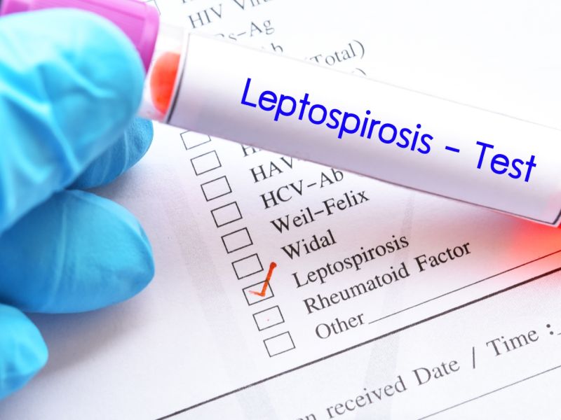 مرض الليبتوسبيروسس: الأعراض، التشخيص، العلاج