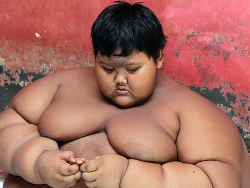Arya Permana when weighing 31st 6lbs when he was just ten-years-old and had become Indonesia's fattest boy (dailymail)