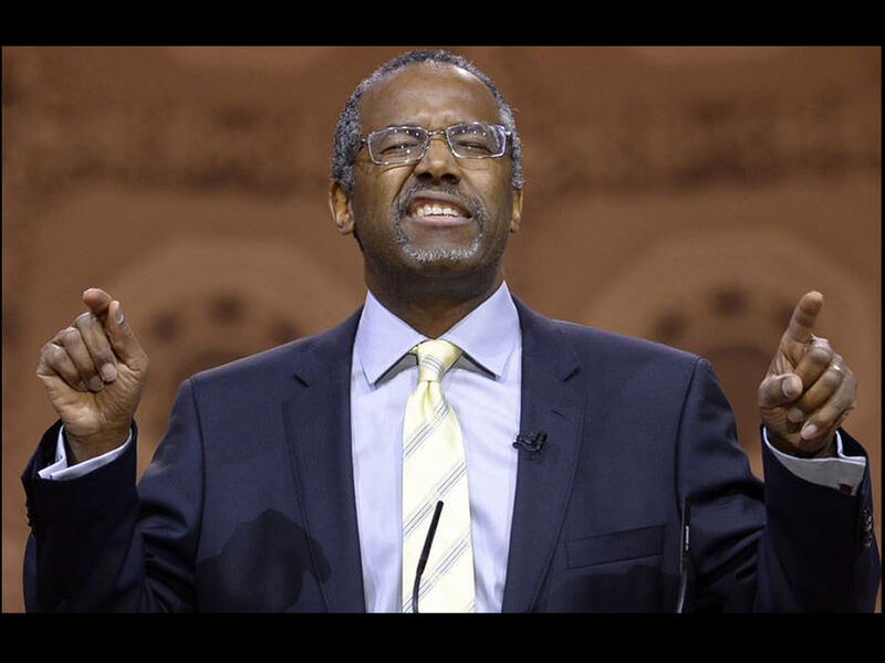 ben carson dumb face