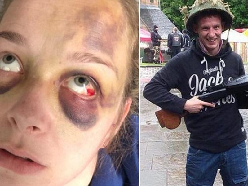 Former soldier headbutted his girlfriend leaving her with horrific face injuries (Twitter)