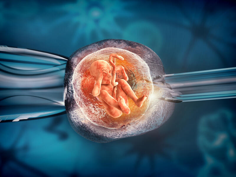 (Shutterstock/ File Photo)