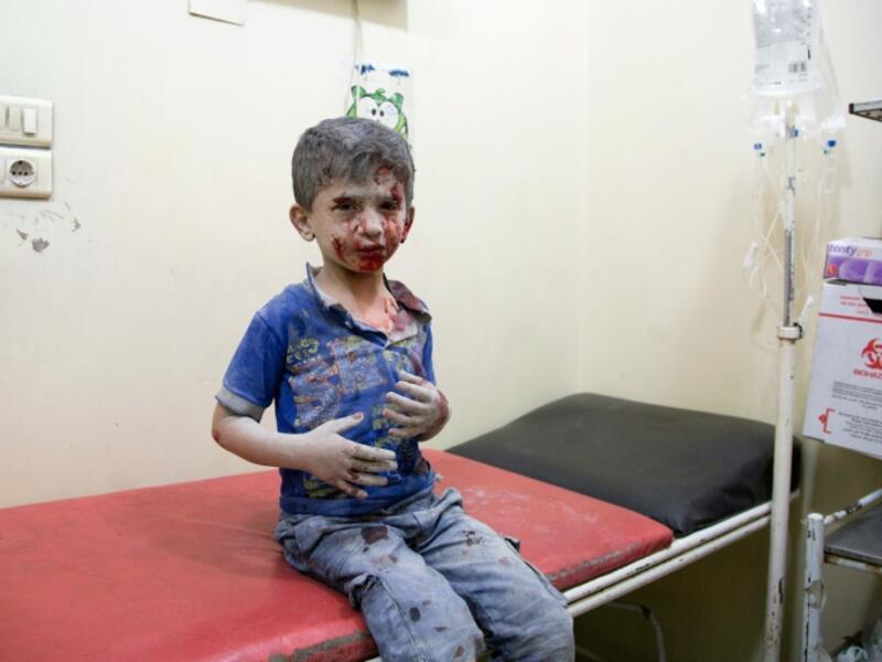 A Syrian boy awaits treatment at a make-shift hospital following air strikes on rebel-held eastern areas of Aleppo. (AFP/Karam al-Masri)