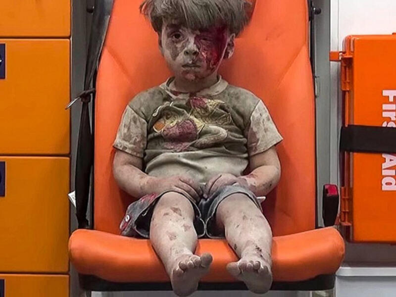 Damned if you stay, damned if you go: A young Syrian boy sits injured in the back of an ambulance after being pulled from the rubble by civil defense workers following a reported government airstrike in eastern Aleppo.