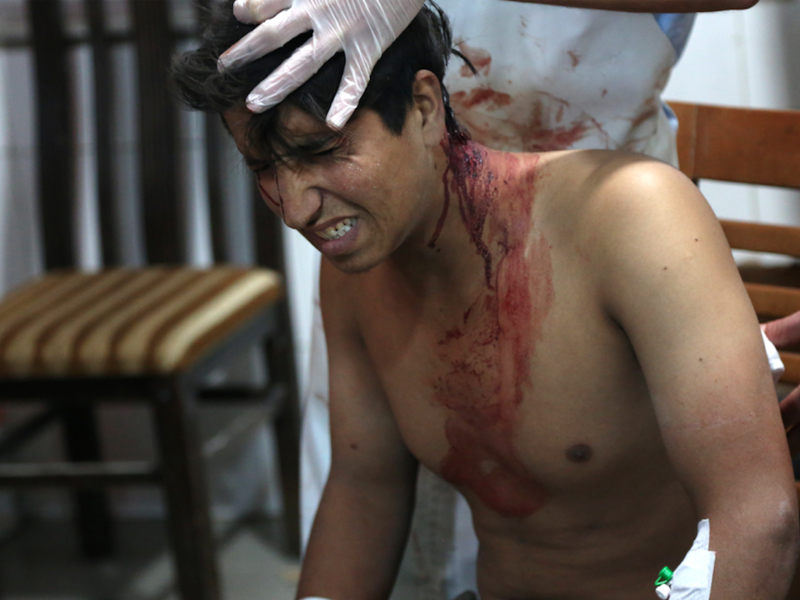 A Syrian man receives treatment at a make-shift hospital in Kafr Batna following government air strikes on the town of Jisreen, in the besieged Eastern Ghouta region on the outskirts of the capital Damascus, on Feb.19, 2018. 