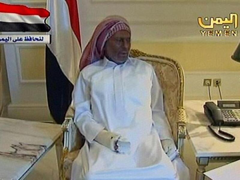 Ali Abdullah Saleh suffered serious burns.