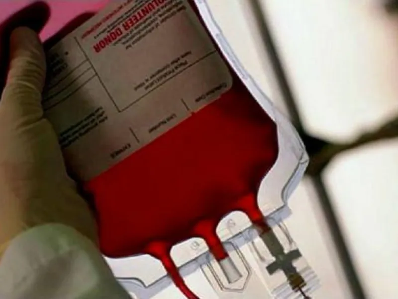  Donate blood instead! Some Shia leaders and groups discourage 
the bloodletting, concerned that it creates a negative, if not backward, image of Shia Muslims. 
These leaders encourage people to donate blood instead.