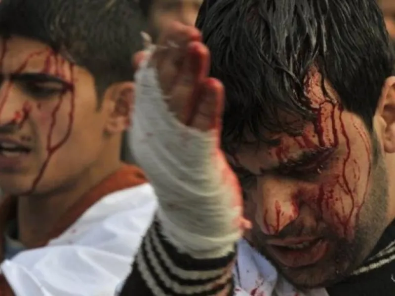 Ashura's rituals: Shia men & women dressed in black parade the streets slapping their chests & 
chanting. Things can get ugly, even violent, with all the raised testosterone around (even if mostly directed at oneself).
Still, today, blood-spilling or self-injury is frowned upon and has been toned down, or kept to the minimum symbolic gestures.
