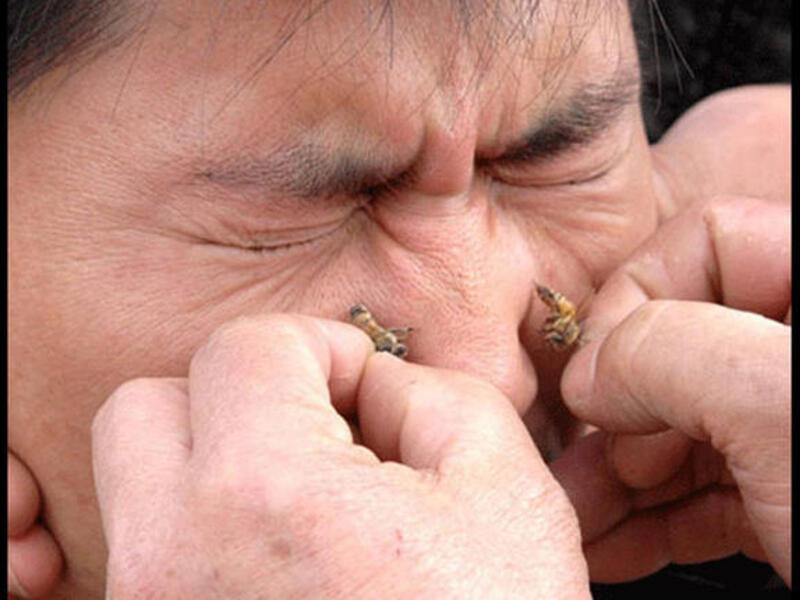 Bee sting facial