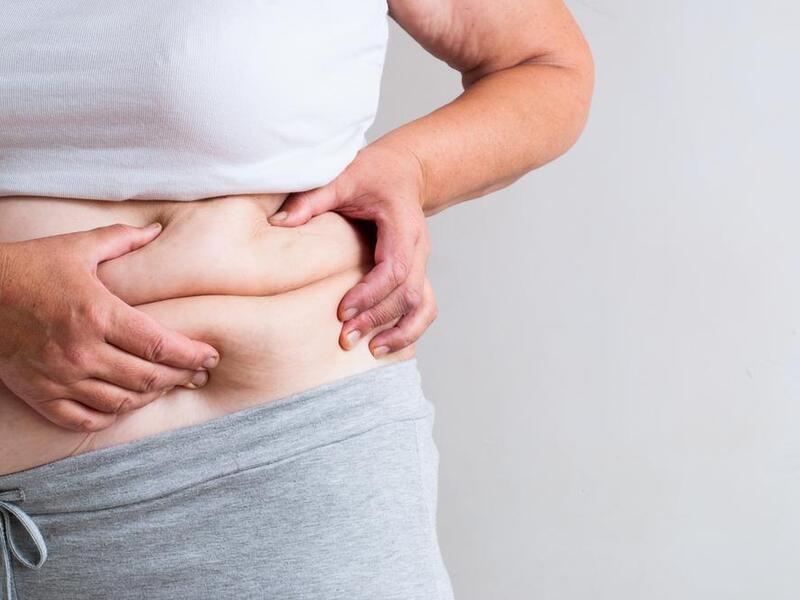 Weight loss surgery is a growing trend in Jordan. (Shutterstock)
