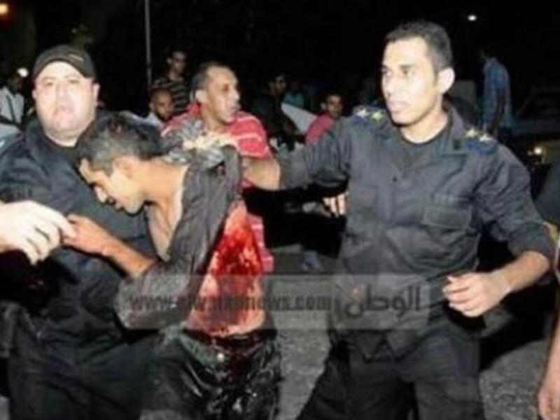 Alleged Crucifixion Victim