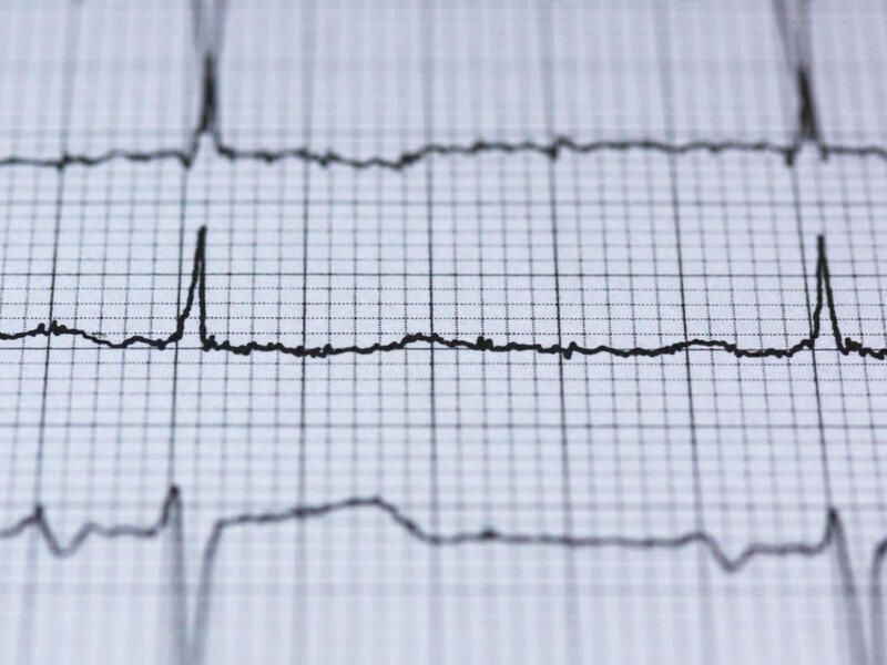 من أعراض النوبة القلبية الشعور بالضغط والضيق والألم في الصدر والذراعين 