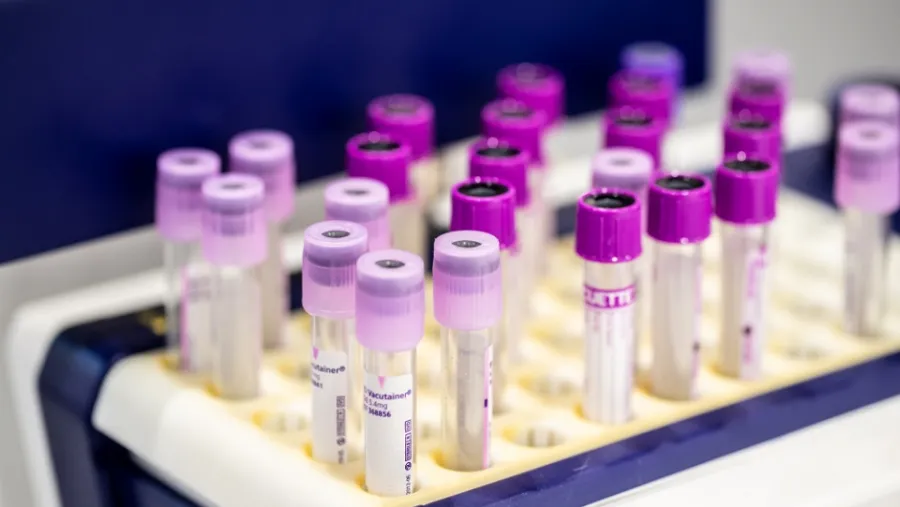 Medlab Middle East To Address Increased Demand For Covid-19 Testing