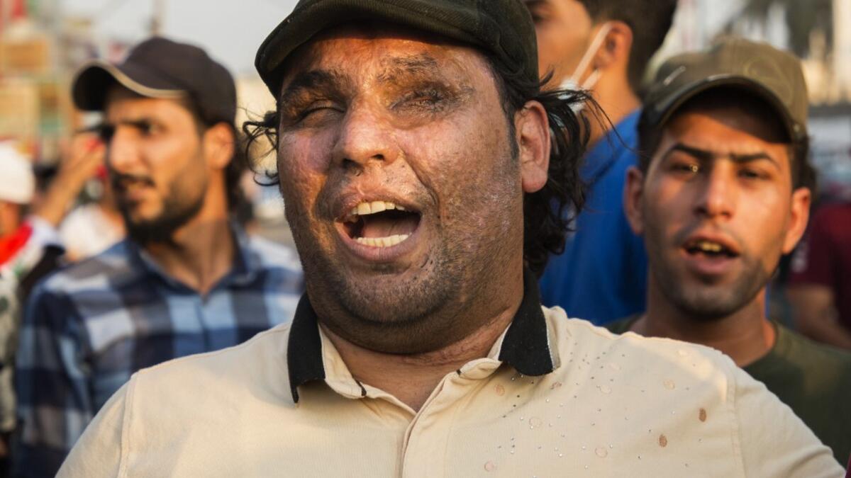 An Iraqi protestor wounded in war shouts slogans during a demonstration against state corruption, failing public services and unemployment, on October 2, 2019 in the southern city of Basra. Popular protests multiplied across Iraq today as thousands of demonstrators braved live fire and tear gas in rallies that have left seven dead in the past 24 hours. Hussein FALEH / AFP