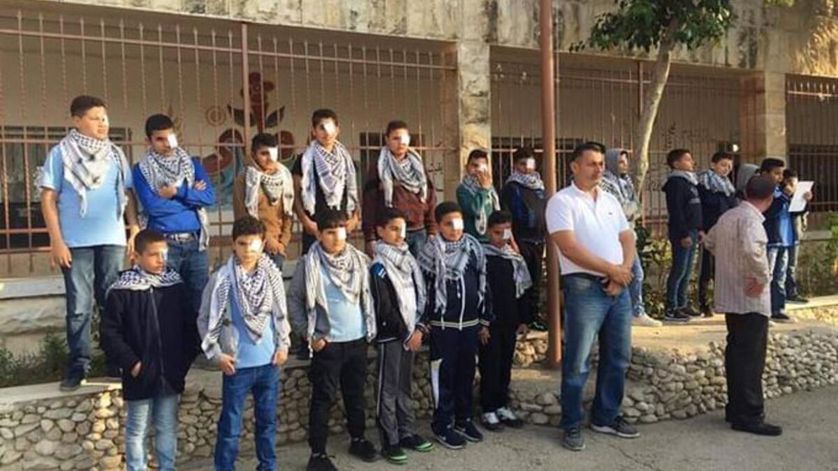 Palestinian journalists launch a campaign  in solidarity with photojournalist Muath Amarneh who lost his left eye because of an Israeli bullet while covering protests in Hebron on 15 November (Twitter)