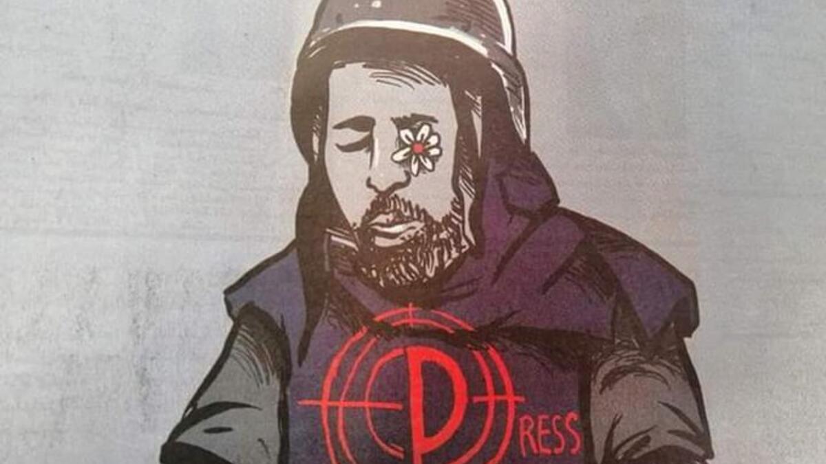 Palestinian photojournalist Muath Amarneh lost his left eye by Israeli sniper fire while covering protests in Surif near Al-Khalil (Hebron). The Israeli army bears full responsibility and the sniper must be brought to justice for so cowardly targeting a journalist (Twitter)