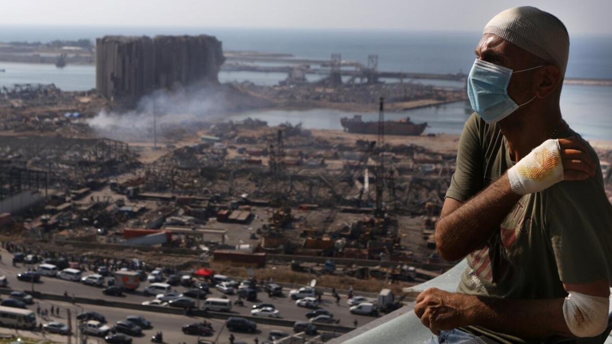 Lebanese TV producer Tony Ahwaji sits injured on the balcony of his damaged apartment in the damaged neighbourhood of Mar Mikhael in the Lebanese capital Beirut on August 6, 2020, two days after a massive explosion shook the Lebanese capital. The blast, which appeared to have been caused by a fire igniting 2,750 tonnes of ammonium nitrate left unsecured in a warehouse, was felt as far away as Cyprus, some 150 miles (240 kilometres) to the northwest. The scale of the destruction was such that the Lebanese ca