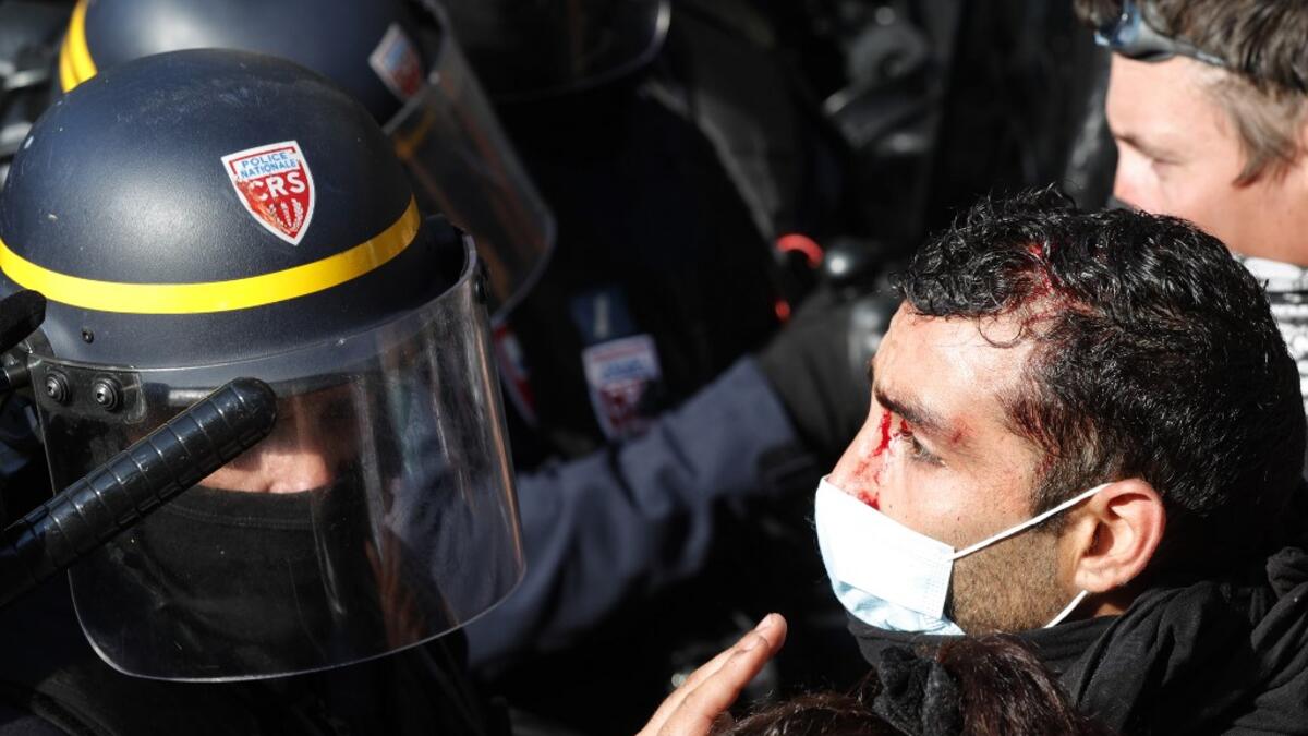 A man, with a slight head injury, confronts French riot police during a demonstration called by the "yellow vest" (Gilets Jaunes) movement in the French capital Paris on September 12, 2020. It is not clear how the protester was injured. GEOFFROY VAN DER HASSELT / AFP