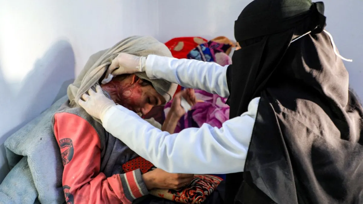 Al-Anoud Hussain Sheryan, a 19-year-old girl disfigured in an acid attack by her abusive husband, sits at a hospital where she is undergoing treatment in Yemen's capital Sanaa on January 28, 2021 as a woman unwraps her veil to show her injuries. Married at the age of 12, rejected at 16, and then disfigured in an acid attack, Sheryan's fate is a shocking illustration of abuse in a society beset by war and poverty. Now aged 19, the young Yemeni woman agreed to relate her ordeal at the hands of her abusive hus