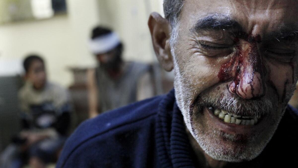 Kamal, the father of an eight-year-old girl who was fatally wounded along with his son Hamed