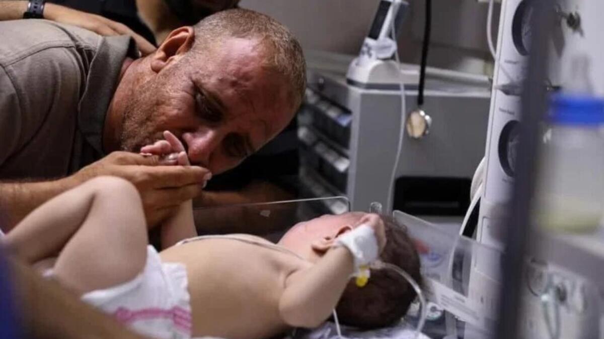 الإصابات: 1910 إصابة ومن بينها 560 طفلًا، و380 سيدة، و91 مُسنّا.