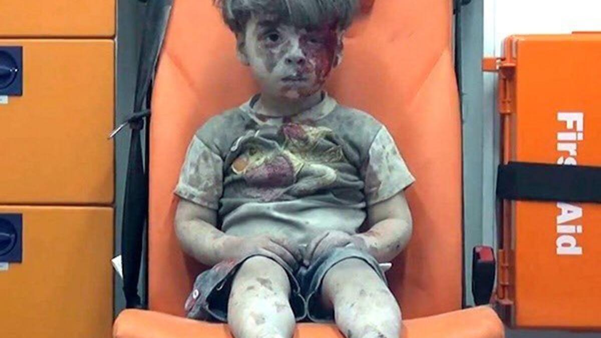 الطفل السوري عمران، الذي أصبحت صورته رمزًا للحرب في سوريا بعد لحظات من انتشاله من تحت أنقاض مبنى منهار. كان هذا في أغسطس عام 2016.