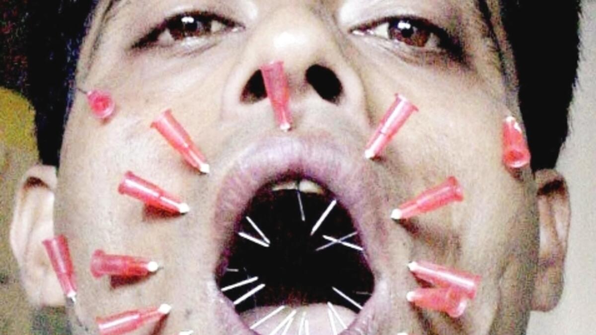 Patesh Talukdar, from Assam state, pierces his face with 23 needles during an attempt to make it into the annals of the Guinness Book of World Records November 11, 2002 in Guwahati. Talukdar has already made it into the Limca book of records with his bizarre feat of consuming bulbs and bricks. (AFP Photo)