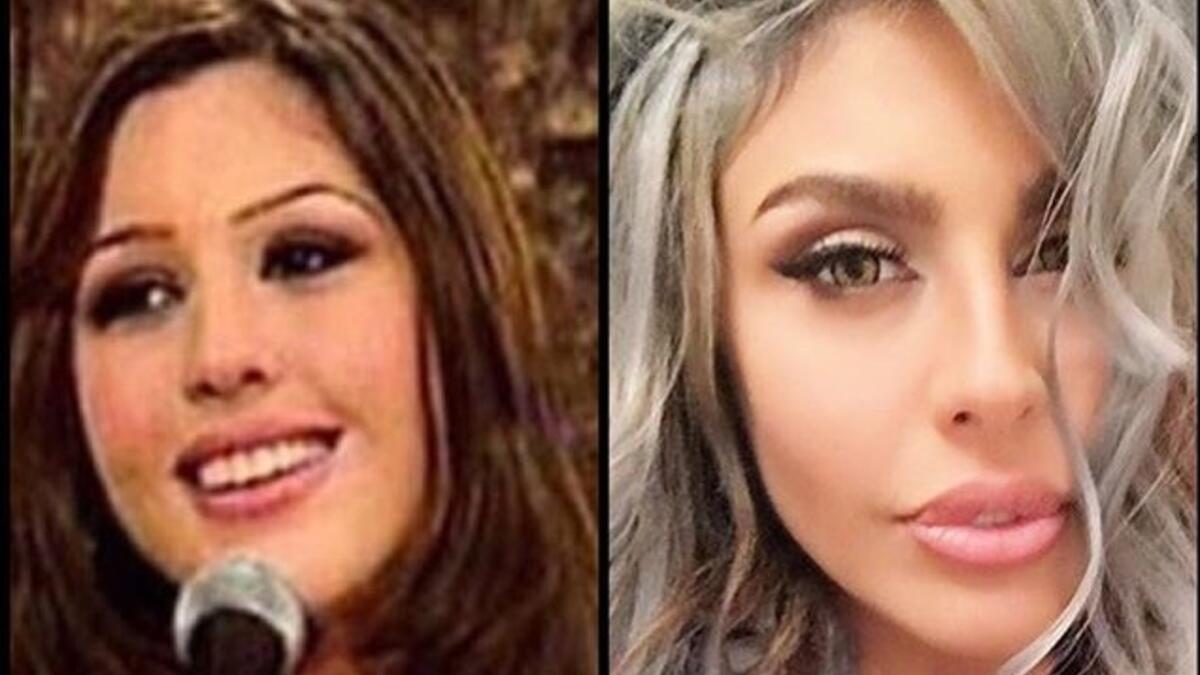 إستعادت الفنانة ليلى اسكندر ذكريات في برنامج ستوديو الفن بصورة سببت مفاجأة لجمهورها، حيث بدت بشكل مغاير تماماً عما تبدو عليه حالياً، حيث كشفت الصورة عن حجم عمليات التجميل التي خضعت لها، حتى غيرت ملامحها ولون بشرتها تماماً.