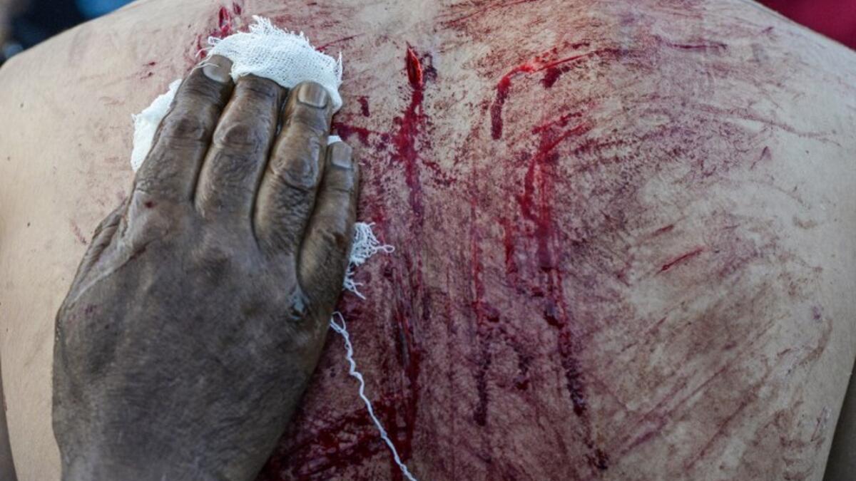 A medical volunteer cleans the blood on the back of a Kashmiri Shiite Muslim mourner who flagellates himself during a religious procession held on the seventh day of Ashura which remembers the slaying of the Prophet Muhammed's grandson in southern Iraq in the seventh century, in Srinagar on September 18, 2018.TAUSEEF MUSTAFA / AFP