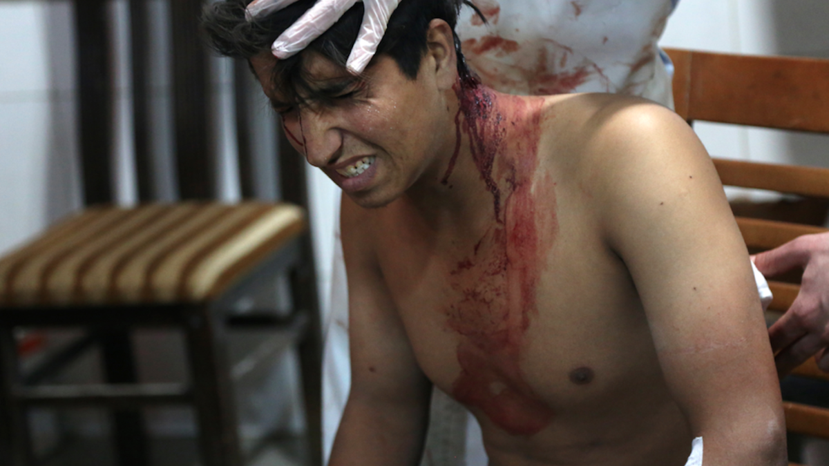 A Syrian man receives treatment at a make-shift hospital in Kafr Batna following government air strikes on the town of Jisreen, in the besieged Eastern Ghouta region on the outskirts of the capital Damascus, on Feb.19, 2018.