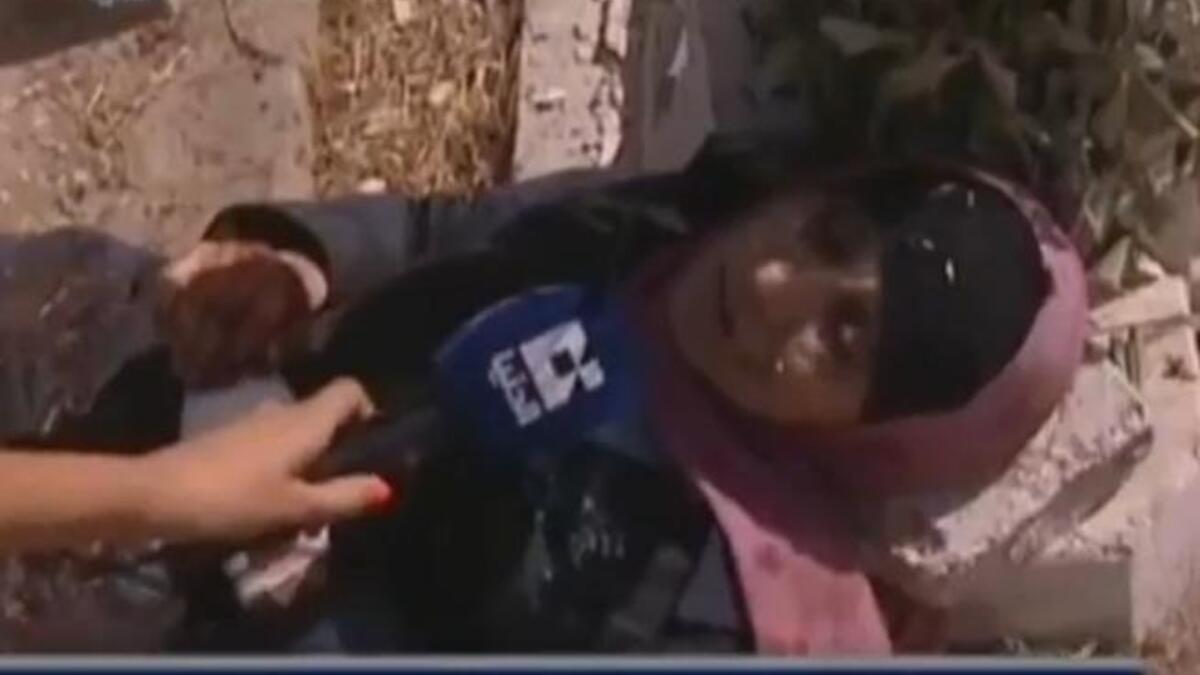 سيدة مصابة من ضحايا مجزرة داريا