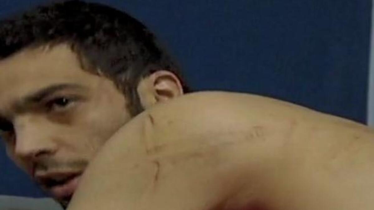 Reports of that same 'hand' of the trusted military raining down blows on its people with iron rods, electrical devices, and the stamping of its army boots on the  face of victim, singer and protester, (Rami Issam ,below), one of many tortured during crackdown in March.