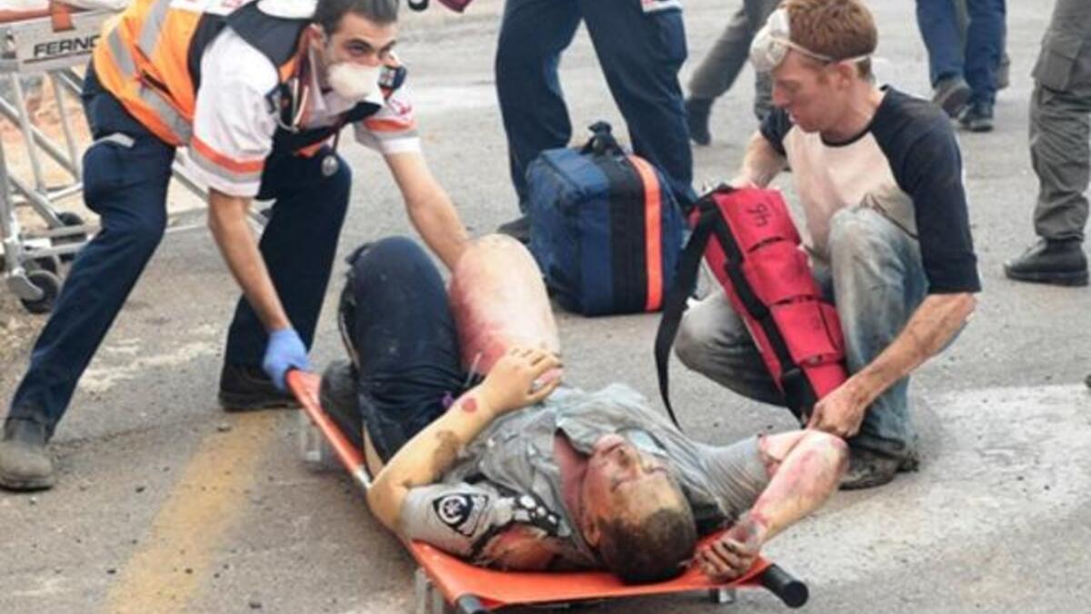 Israeli medics evacuate a burnt policeman from the site of raging fire in the Carmel Forest near Israel northern city of Haifa
