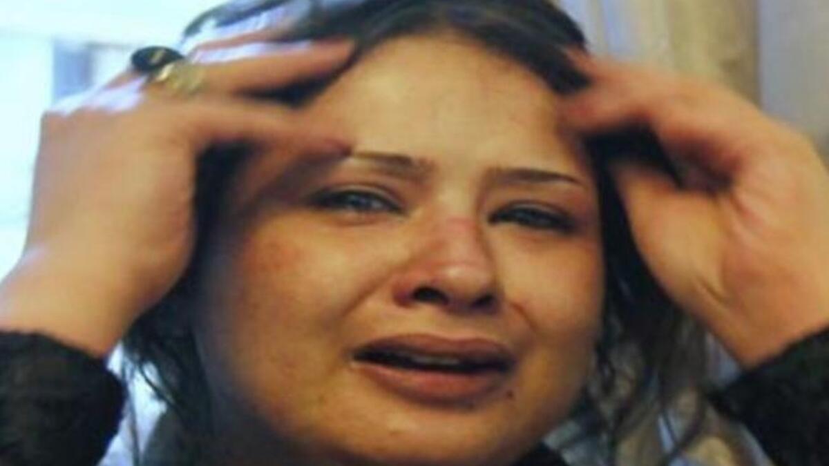 دخلت ايمان العبيدي فندقا يقيم فيه مراسلون اجانب يوم السبت كي تريهم رضوضا وندوبا قالت ان افراد بميليشيات القذافي تسببوا فيها.