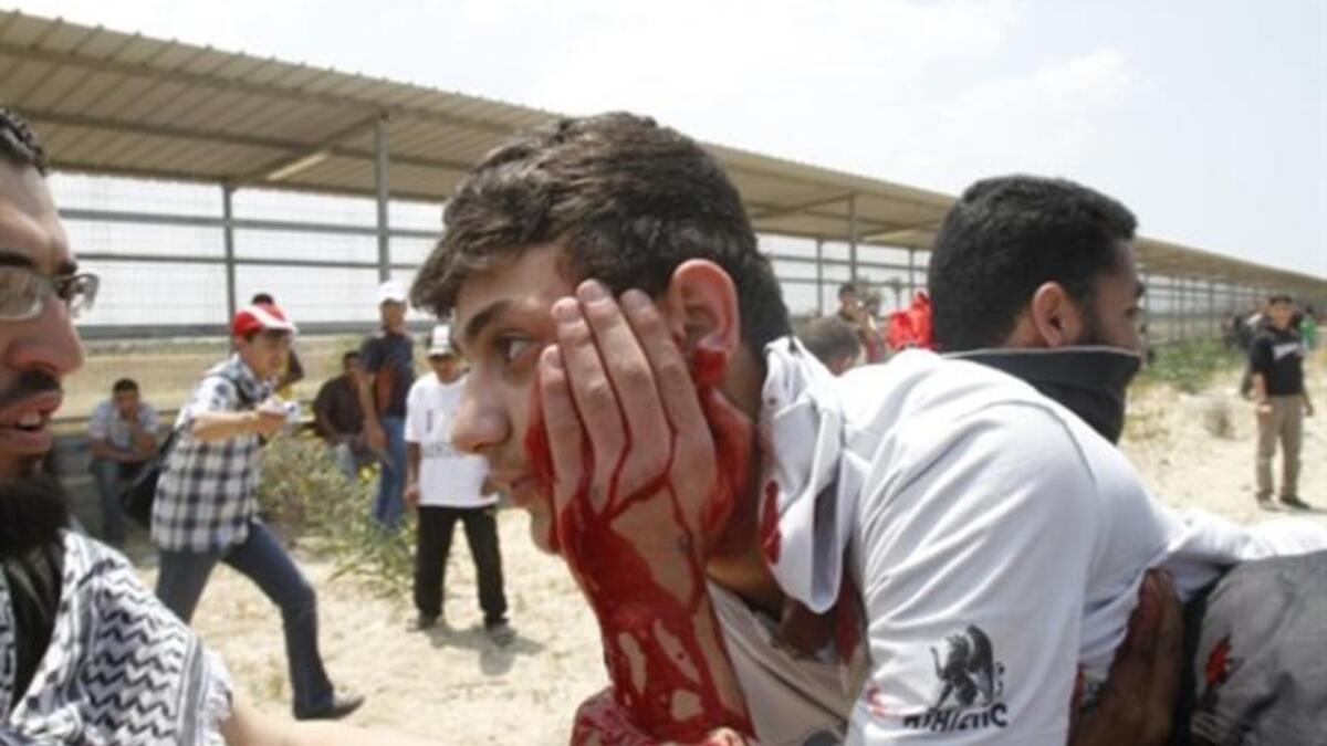 Gaza Guard: Palestinians carry away a wounded man as Israeli troops opened fire during on a massive march heading towards the Erez border crossing in the northern Gaza Strip. 45 injuries counted.