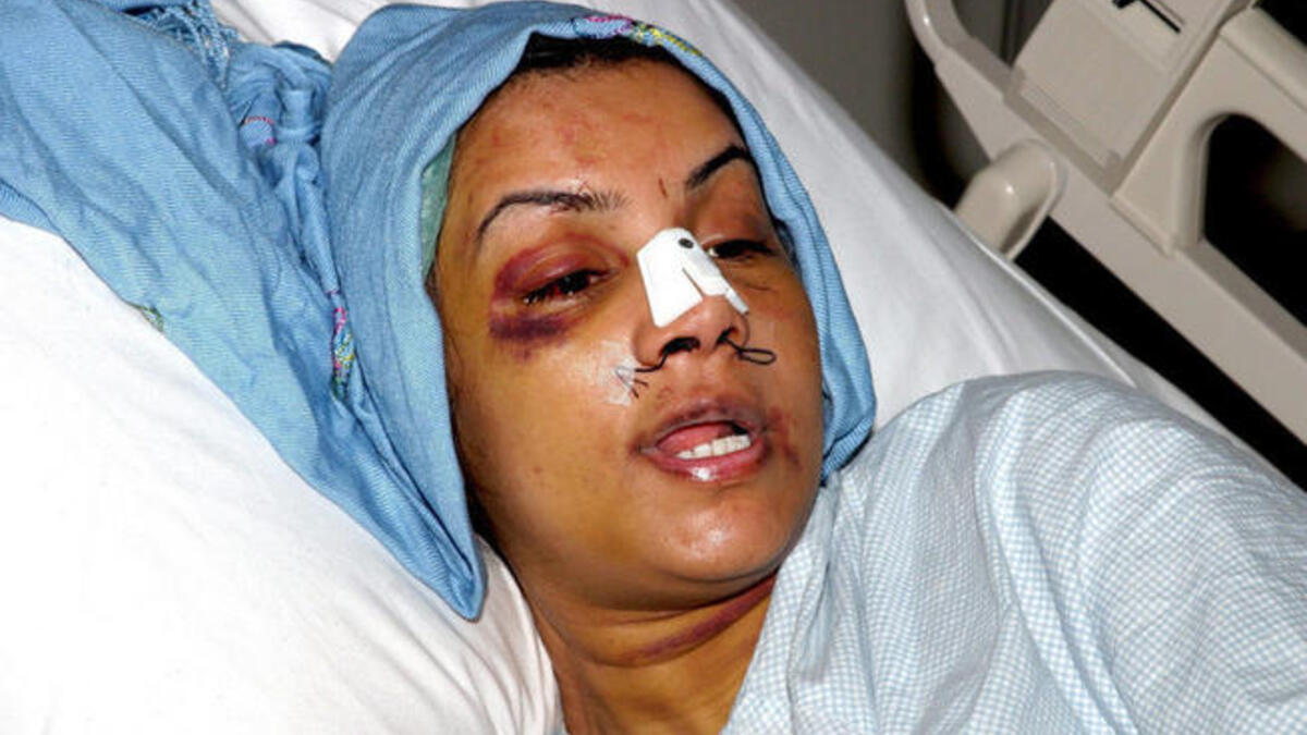 قامت رانيا الباز بوصف معاناتها مع زوجها وتم عرض صورها بالمستشفى، وفي نهاية الحديث قالت أوبرا : "إنني محظوظة لكوني أمريكية"!.