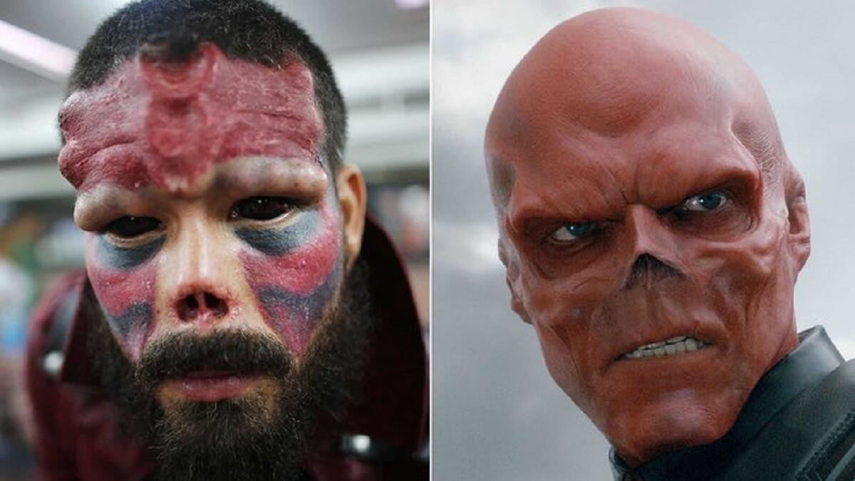 حملَ الفنزويلي هنري دامون (37 عاماً) لقب "الجمجمة الحمراء" بعد أن طلى وجهه باللون الأحمر، وأزال جزءاً من أنفه ليشبه عدو كابتن أمريكا في الفيلم الشهير، كما سبق له أن أجرى عمليات للحصول على نتوءات عديدة في وجهه وذراعيه.