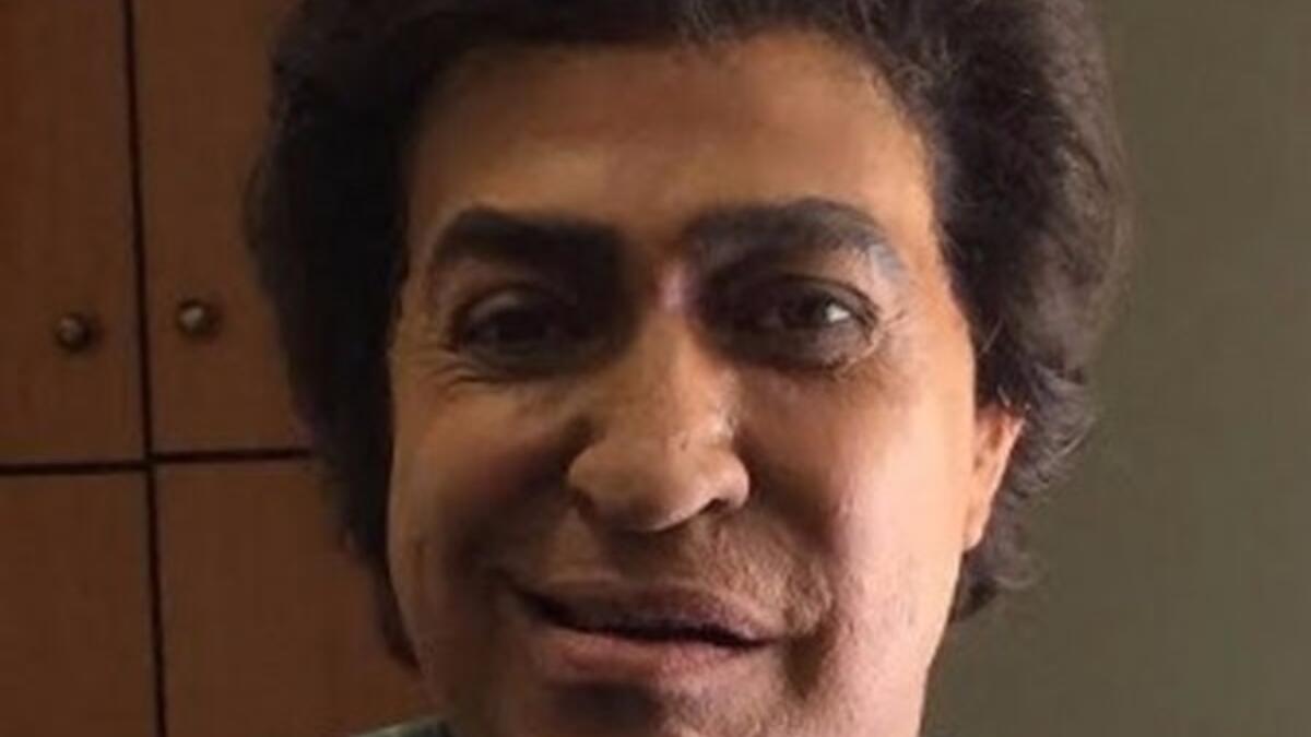 أعلن الفنان حكيم تضامنه مع الفنان الكبير أحمد عدوية وذلك بعد مطالبة الموسيقار حلمي بكر له باعتزال الفن بالتوقف على الغناء حكيم عبر عن تضامنه بطريقة مبتكرة حيث تقمص شخصية عدوية وخضع لماكياج جعله شبه ملامح عدوية لحد كبير وحرص على ارتداء ملابس تشبه ملابس عدوية.