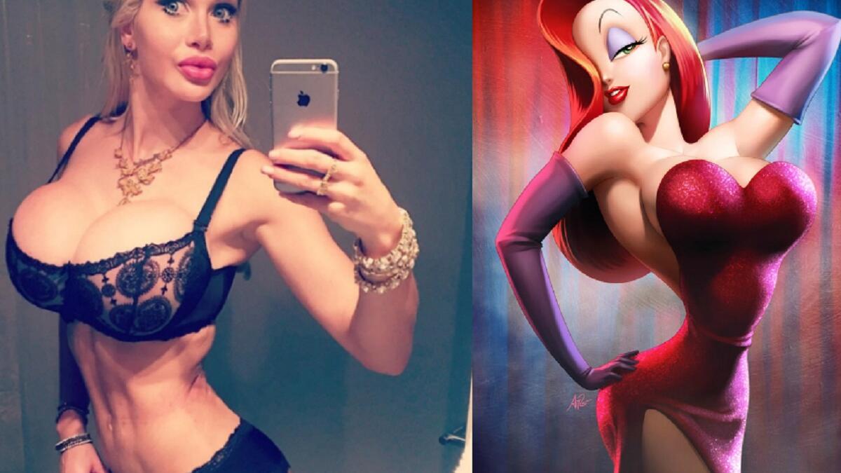 عارضة الازياء السويدية بيكسي فوكس (25 عامًا)، أنفقت حوالي 135 ألف دولار لتصبح شبيهة بشخصيات ديزني الكرتوني، وكانت آخر عملية تجميل أجرتها فوكس إزالة نحو 6 أضلع من قفصها الصدري للحصول على خصر نحيف جداً.