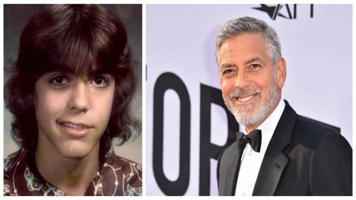 الممثل الأمريكي جورج كلوني: أصيب بشلل الجرس خلال السنة الأولى من المدرسة الثانوية، والتي قال إنها كانت وقتًا سيئًا للإصابة بهذا الاضطراب البدني. وهو اضطراب جسدي يصبح فيه أحد جوانب الوجه ضعيفًا أو مشلولًا بشكل تام.