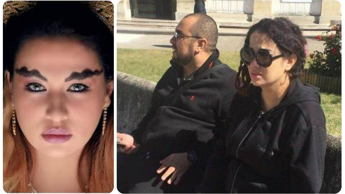 نشرت ريم غزالي، بنشر صورة لها عبر خاصية "الستوري" في حسابها على "إنستغرام"، وذلك بعد الجراحة التي خضعت لها، وظهر إلى جانبها في الصورة شقيقها.