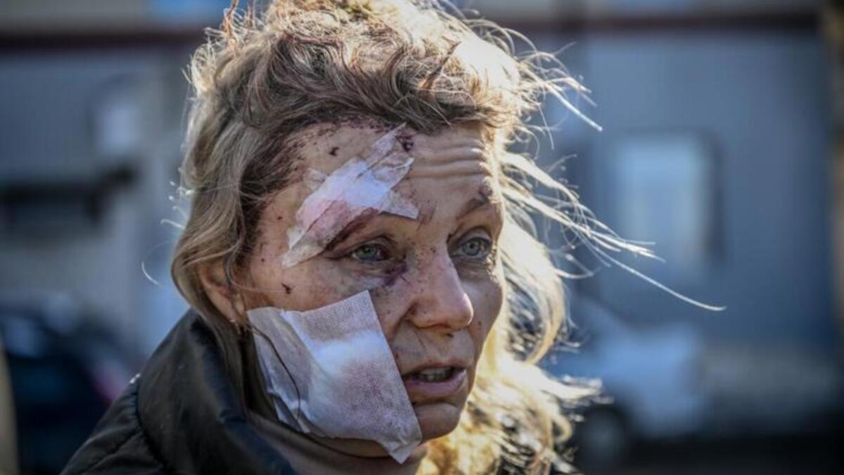 A Month On: Powerful Photos to Come Out of Ukraine