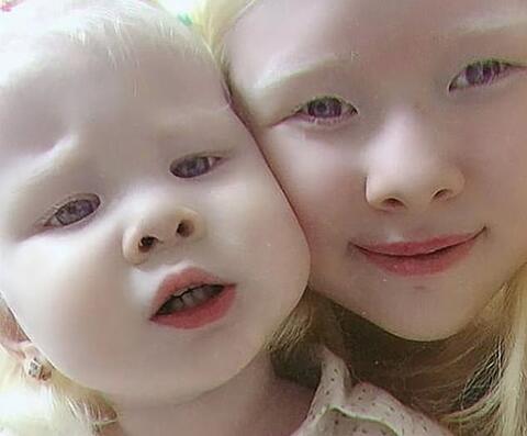 Milky-White! Baby Albino Shark With One Eye Found in Indonesia