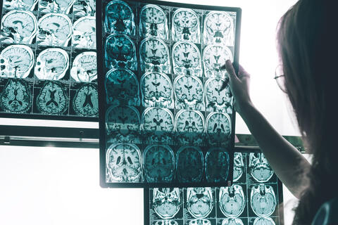 Watch Out: Hot Flushes, Mood Swings And Alzheimer!