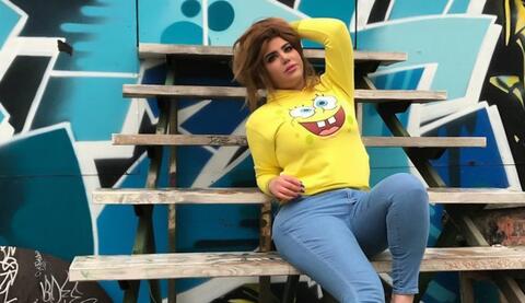 مروة راتب تُشوه نفسها مُجدداً وهذه المرة عن طريق حقن الشفاه.. تحولت لـ بطة!