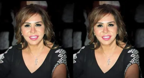 مها المصري نتيجة خطأ تجميلي جديد.. والجمهور يرفض التصديق