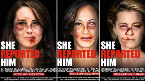 Why Are The Faces of These Public Figures Covered in Cuts and Bruises?