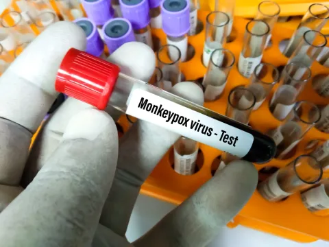 WHO: Monkeypox Will Not Evolve Into a Pandemic