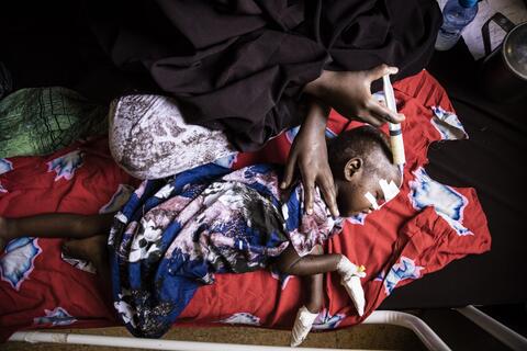 Will The UN Be Able to Prevent Famine, Tackle Drought in Somalia?