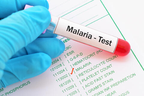 Can Nigeria Put an End of Malaria?